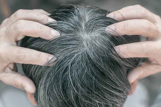 penyebab-rambut-menjadi-uban.jpg